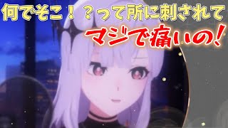 【アルバ・セラ】点滴されすぎて痛いところに刺された話をするアルバ・セラ【切り抜き】