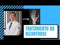 Treatment of rhizarthrosis