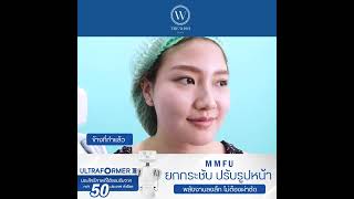 MMFU Ultraformer III ยกกระชับ ปรับรูปหน้าที่ดีกว่า Hifu ทั่วไปถึง 5 เท่า