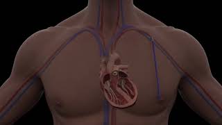 CroiValve - Overview