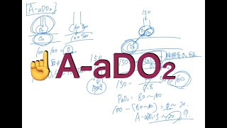 A-aDO2[肺胞気-動脈血酸素分圧較差]