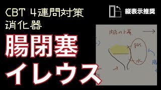 消化器_04【腸閉塞-イレウス】CBT 4連問対策