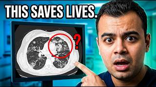 Finding What's Wrong With My Lungs In CT Scan