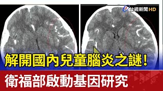 解開國內兒童腦炎之謎！ 衛福部啟動基因研究