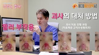 [필러 부작용 이야기] ② 괴사의 대처방법