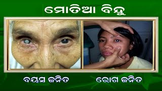 ମୋତିଆବିନ୍ଦୁ ଓ କଳାମୋତିଆ (Cataract and Glaucoma)