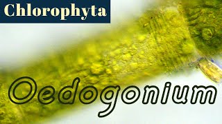 Oedogonium (Chlorophyta or Green Algae)