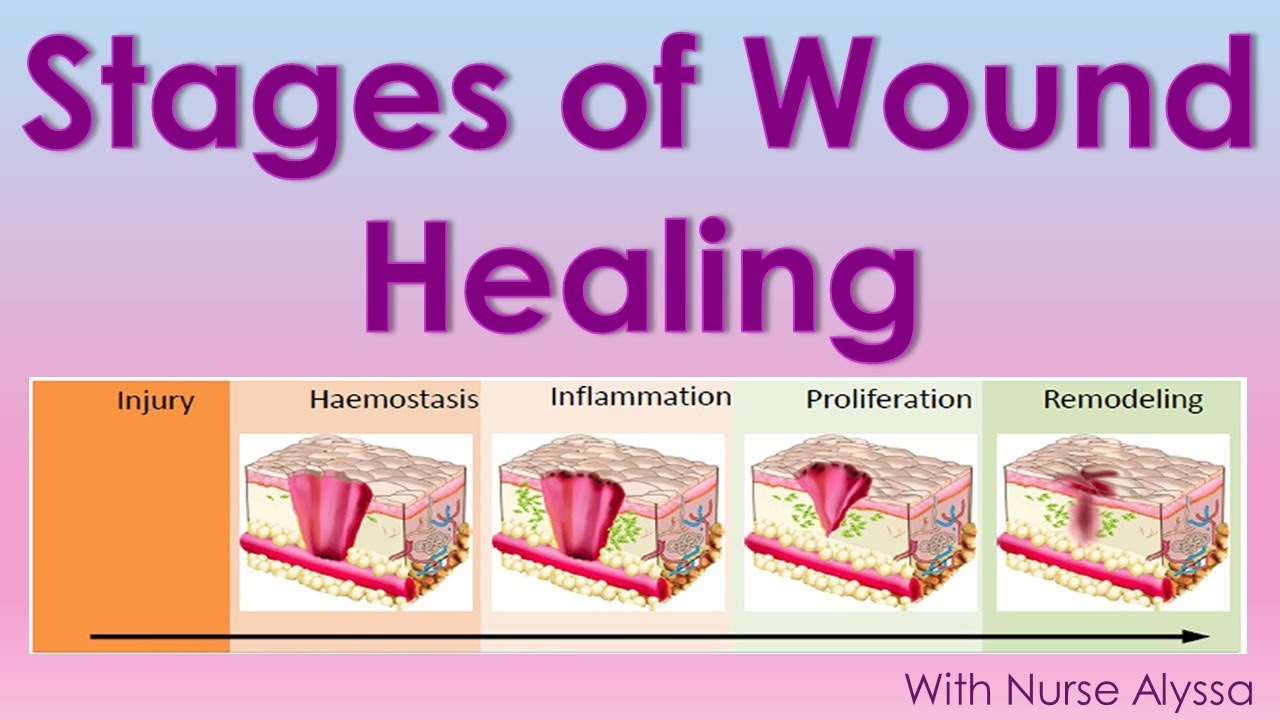 Stages Of Wound Healing - YouTube