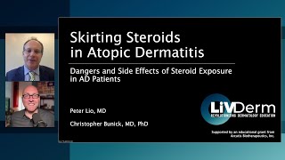 Skirting Steroids in Atopic Dermatitis (Part 1)