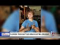 florida 13 year old battles brain eating amoeba after beach trip