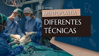 Las diferentes técnicas para una mentoplastia