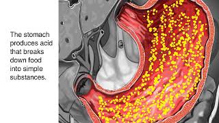 Stomach ulcer-ulcera e stomakut procesi i formimit