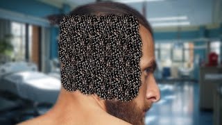 bodybuilder man back side head ka ASMR animation| maggot removal treatment|