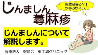 【形成外科・皮フ科】じんましん〜繰り返すじんましん、かゆみの対処法〜