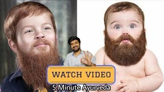 Be A Beardo| घनी दाढ़ी और मूंछ उगाने के सबसे असरदार उपाय |Now Fix PATCHY BEARD Permanently In 7 Days