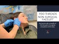 Watch A PDO Thread, Non-Surgical Facelift!