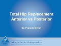 Anterior vs. Posterior Total Hip Replacements - Pros and Cons for the Patient