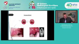 15ο Παιδιατρικό Συνέδριο – Ι. Χριστόπουλος