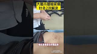 大腿，小腿在抽筋，針灸2次輕鬆解決#知识分享 #中医 #中醫 #医学科普 #健康 #健康科普 #涨知识 #科普 #针灸 #抽筋 #筋骨