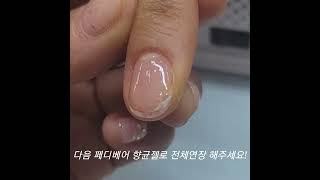 애매하게 찢어진 손톱 보수하고 젤네일 가능한가요?