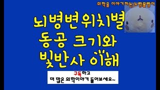 뇌병변위치별 동공이상: pinpoint pupil(점상동공, 교뇌), 고정된 큰 동공(tectal, 동안신경), midbrain