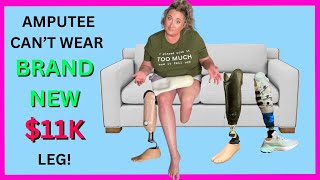 Below the knee amputee buys $11k prosthetic leg and it DOESNT FIT!