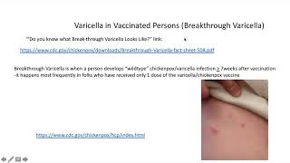Viral Vaccines audio 4 13 2020