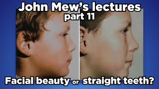 John Mew's lectures part 11: Facial beauty or straight teeth?