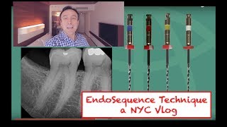 EndoSequence Molar Technique  in NYC Vlog