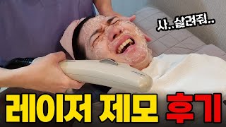 수염 레이저 제모 얼마나 아플까?! 레이저 제모 내돈내산 찐 후기 (가격 / 통증 / 효과 / 부작용)