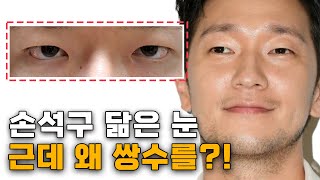 무쌍인데 더 자연스럽게 무쌍으로 수술이요?