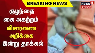 குழந்தை கை அகற்றம் - விசாரணை அறிக்கை இன்று தாக்கல் | Wrong Medication | Baby Issue | TN Govt