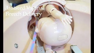 Assisted Vaginal Breech Delivery - Obstetric Emergencies 1 - Prof. Sanjeewa Padumadasa