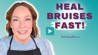 PRO TIP For Healing Bruises Faster!