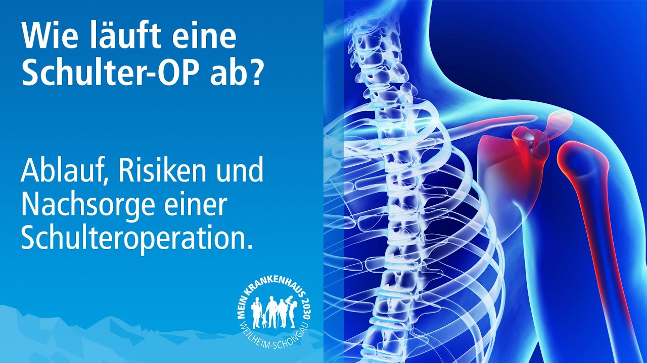 Schulter OP: Ablauf, Risiken Und Nachsorge Einer Schulteroperation ...