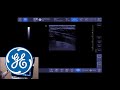 Venue Ultrasound Tutorial: Optimizing B-Mode | GE Healthcare