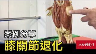 鬼手武醫【膝關節退化案例分享】捉鬼特功27