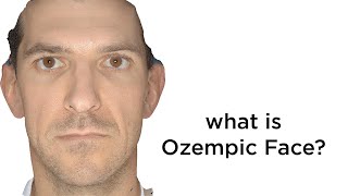 This Is What Ozempic Face Looks Like | Facial Wasting After Rapid Weight Loss | Mounjaro | Wegovy
