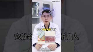 这个性病传播速度非常快，堪比新冠！病毒感染 疱疹 瘙痒 医学科普