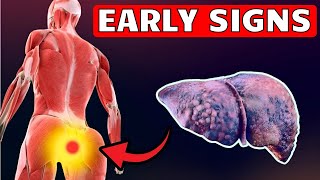 ⚠️LIVER is DYING! 12 Early Signs of LIVER DAMAGE !