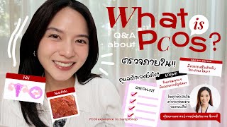 PCOS คืออะไร? มาทำความเข้าใจกลุ่มอาการ PCOS กัน