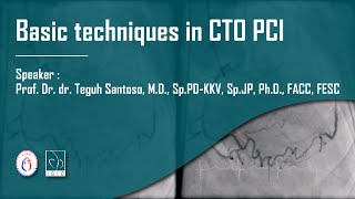 Basic Techniques in CTO PCI