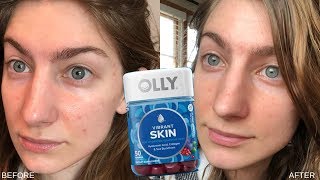 Do Beauty Vitamins Work? | OLLY Vibrant Skin