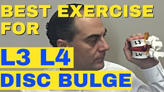 Best Exercise For L3-L4 Disc Bulge, L3-L4 Disc Herniation Dr Walter Salubro Chiropractor in Vaughan