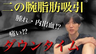 【二の腕脂肪吸引は痛い！？】ダウンタイムについて徹底的に解説します！