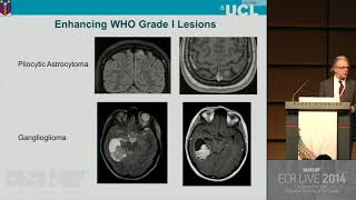 Neuro - Brain tumours   The central role of radiology 2