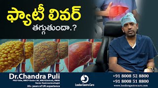 ఫ్యాటీ లివర్, తగ్గుతుందా.? | Dr. Chandra Shekhar Puli | London Gastro Care