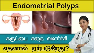 கருப்பை சதை வளர்ச்சி எதனால் ஏற்படுகிறது? endometrial  polyps