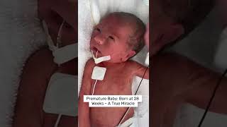 A True Fighter:  28-Week Premature Baby #preemiebaby