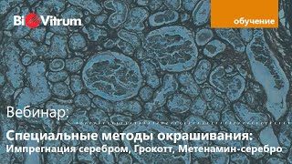 Специальные методы окрашивания: Импрегнация серебром, Гримелиус, Грокотт, Метенамин-серебро